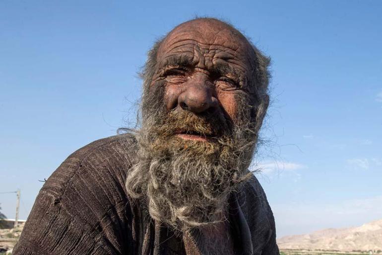 İran’da 70 yıldır yıkanmayan “Hacı Amca”, yıkandıktan sonra öldü