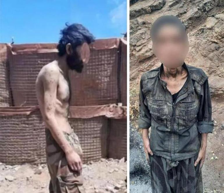 PKKlı terörist teslim oldu Görüntüsü ortaya çıktı: Açlıktan bağırsakları delindi