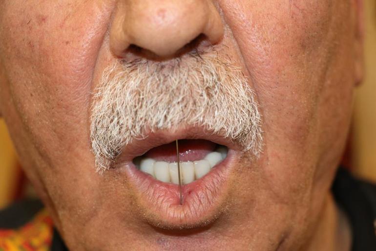 Lebdeğmez geleneğini artık çok azı icra ediyor İki dudak arasına iğne koyarak yasak harfleri kullanmıyorlar