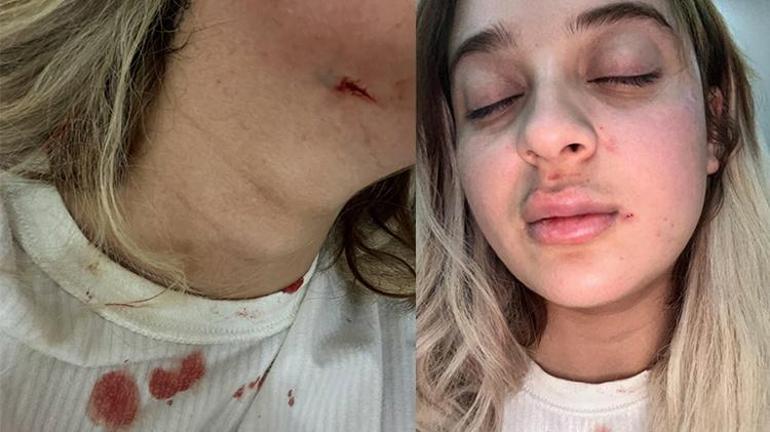 Eski sevgili dehşeti Şantaj, küfür, hakaret ve şiddete uğradı mahkeme sanığı serbest bıraktı
