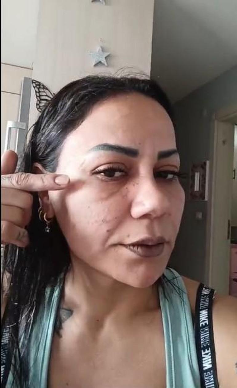 Antalyada estetik kabusu 220 bin TLye bıçak altına yattı, hayatı alt üst oldu