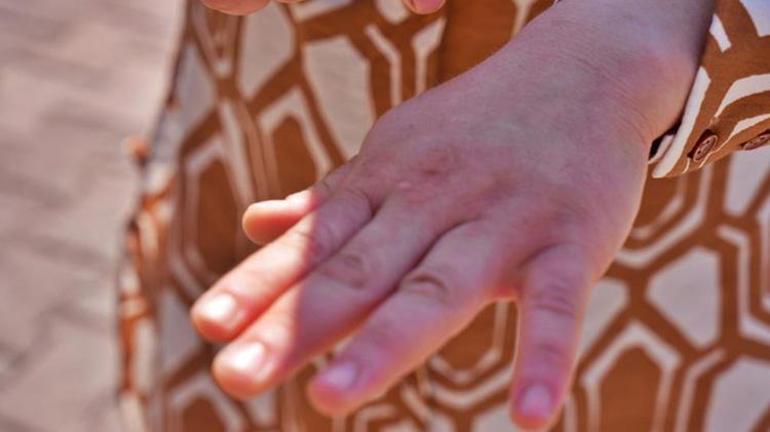 10 kişinin canını yaktı son kurbanı Şükran oldu Vurup kaçtı geride tamponu ve plakası kaldı