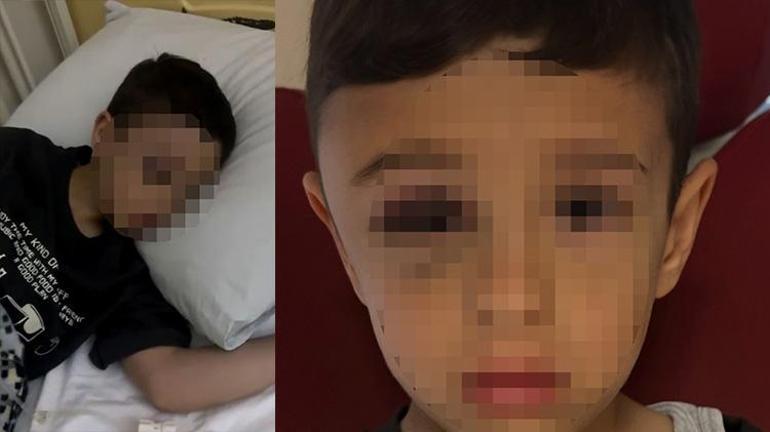 Ergenler bir çocuğun daha hayatını kararttı Samsunda ayaklarından ve kollarından tutulup fırlatılan çocuk beyin kanaması geçirdi