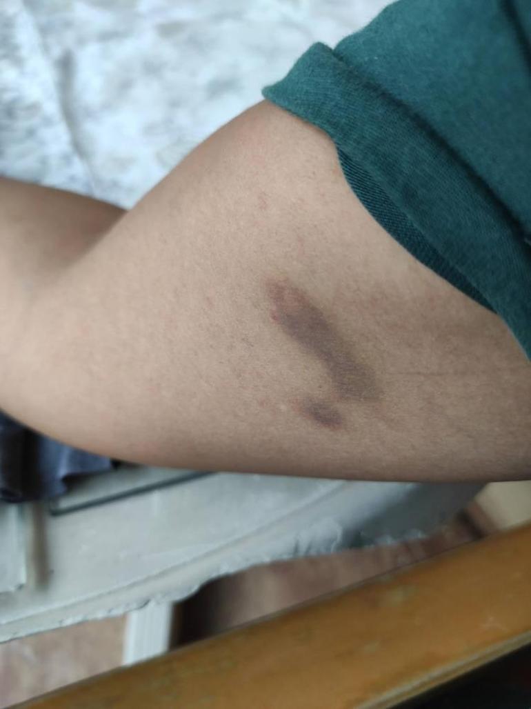 Genç kadının evlilik hayali kabusa dönüştü Hamileyken şiddet uyguladı, bebeğimi kaçırdı, aracımı çaldı