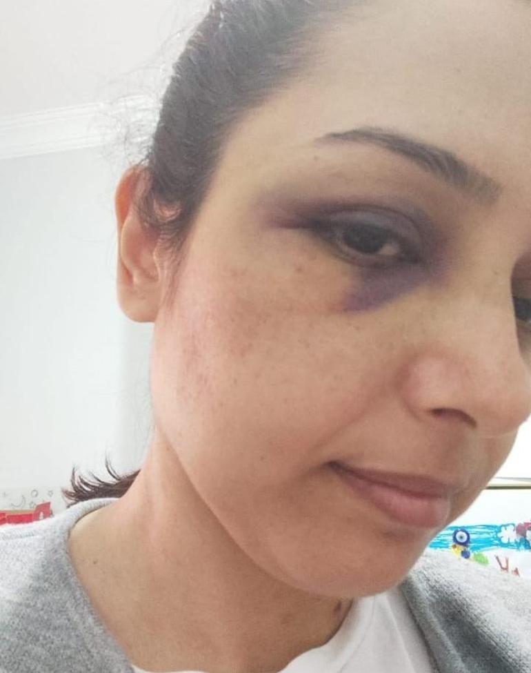 Genç kadının evlilik hayali kabusa dönüştü Hamileyken şiddet uyguladı, bebeğimi kaçırdı, aracımı çaldı