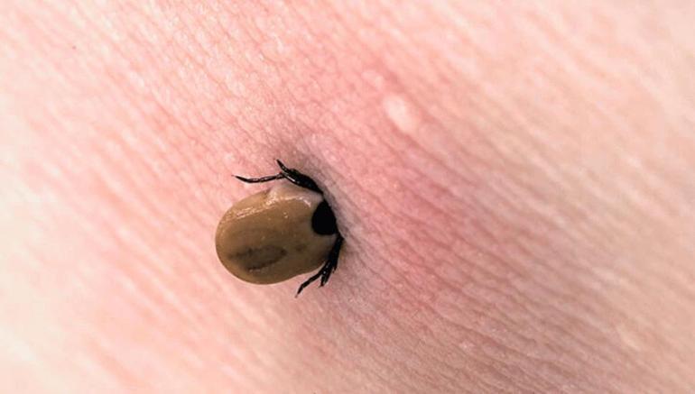 Türkiyede 7 şehirde görüldü Kene hakkında doğru bilinen 10 yanlış