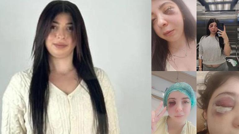 Samsunda Damla Korkmazı dövüp taciz eden şüpheli ilk duruşmada serbest bırakıldı