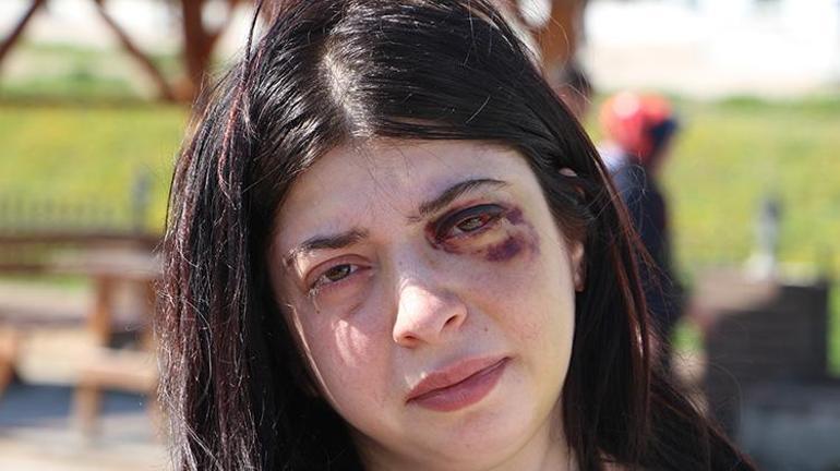 Samsunda Damla Korkmazı dövüp taciz eden şüpheli ilk duruşmada serbest bırakıldı