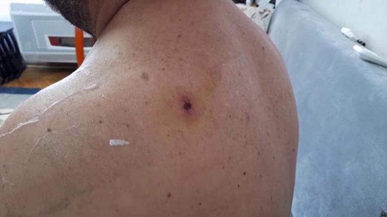 Ölüm saçan yorgun mermilere dikkat Uzmanlardan hayati uyarı: Silah sesi duyunca balkona koşmayın, saklanın