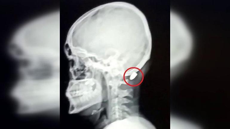 Ölüm saçan yorgun mermilere dikkat Uzmanlardan hayati uyarı: Silah sesi duyunca balkona koşmayın, saklanın