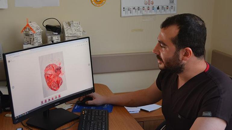 Karın şişliği şikayetiyle hastaneye gitti böbreğinden çıkan doktoru bile şaşırttı