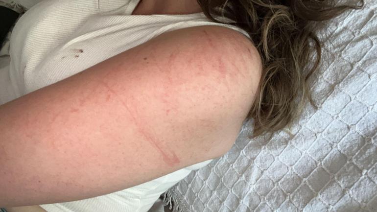 Bursada sokak ortasında yaşandı Bilezikleri istemedi, 310 lirasını çaldı