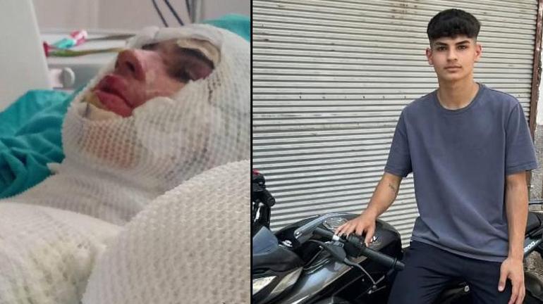 Adanada gerçek kamerada ortaya çıktı: Amcası oğlumu benzin döküp yaktı