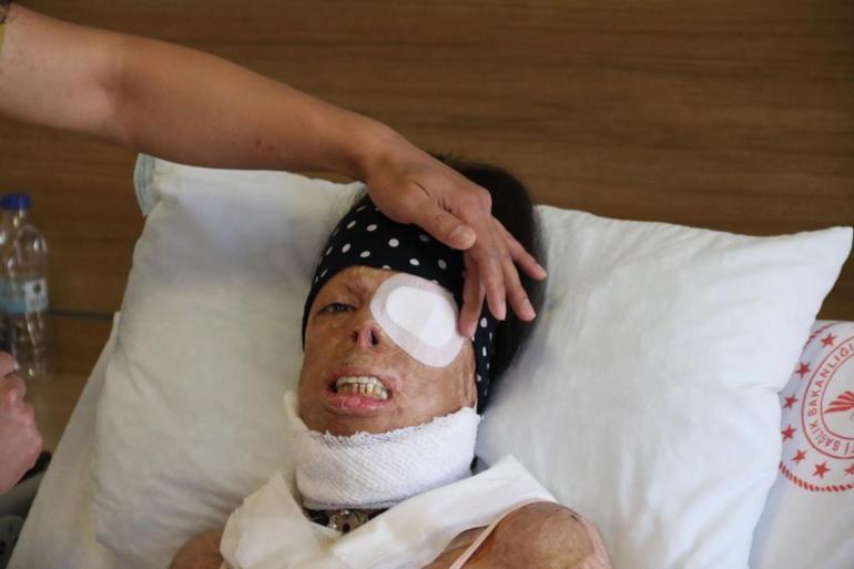 Eskişehirde sevgilisine dehşeti yaşattı: Talihsiz kadının anlattıkları korku filmlerini aratmıyor