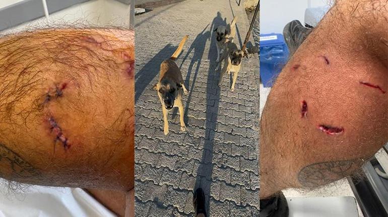 Muğlada köpek saldırısına uğrayan vatandaşın bacağına 5 dikiş atıldı Belediyeden şikayetçi oldu