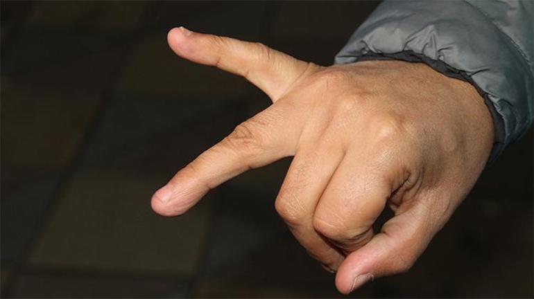 Eskişehirde pes dedirten olay İade etmek istediği balıklarla darp edildi, parmağından oldu