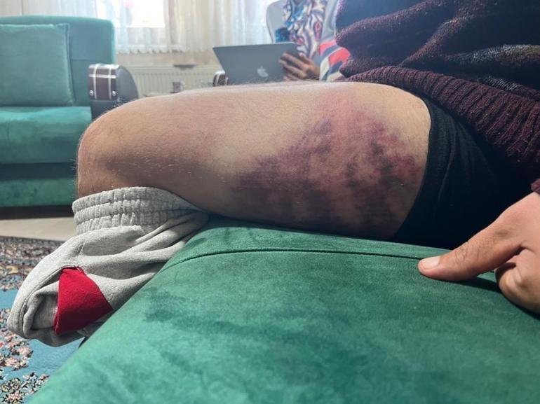 Kocaelide vicdanları yaralayan olay Otizmli genç, odunluğa baktı diye odunla öldüresiye dövüldü