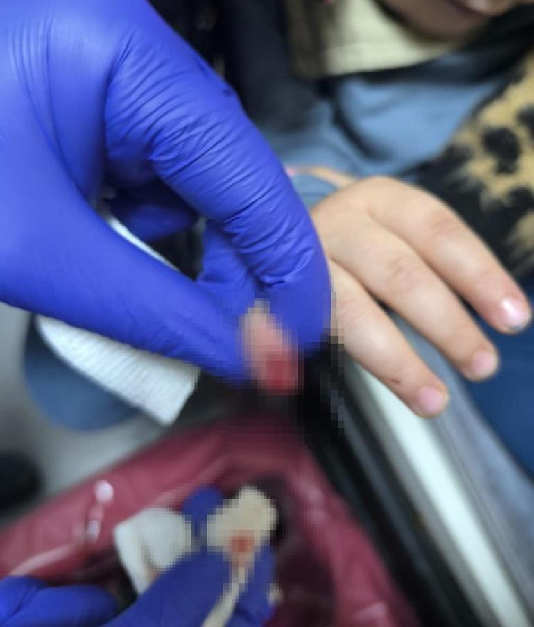 AVMde dehşet anları... Yürüyen merdivene eli sıkışan 3 yaşındaki çocuğun parmağı koptu