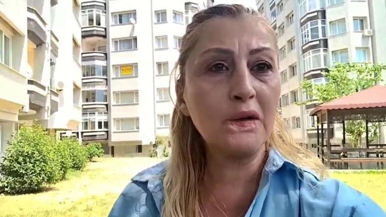 Estetik yaptırdı hayatı karardı İşlem sonrası dudağı çürüdü, 7 yıldır çare arıyor