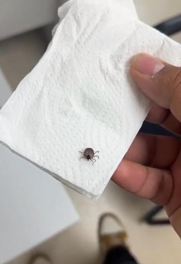 Eskişehirde kene kâbusu: Kulak zarına yapıştı