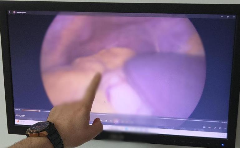 Samsunda inşaat işçisi sağlık raporu için gelince doktor inanamadı: Senin kalbin yok mu