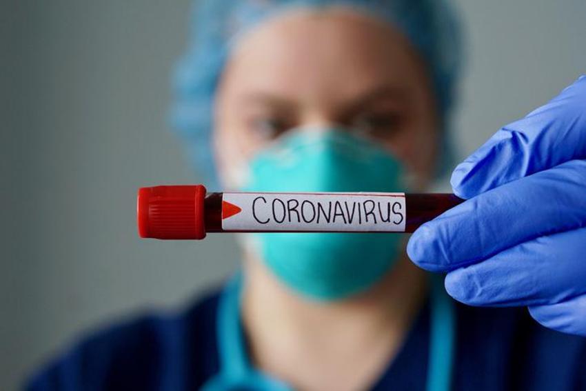 Corona virüse karşı ülkelerin aldığı çok ilginç önlemler!