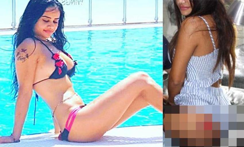 Naz, kalçasına öyle bir şey yaptırdı ki...