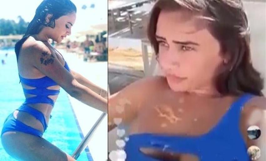 Naz, kalçasına öyle bir şey yaptırdı ki...
