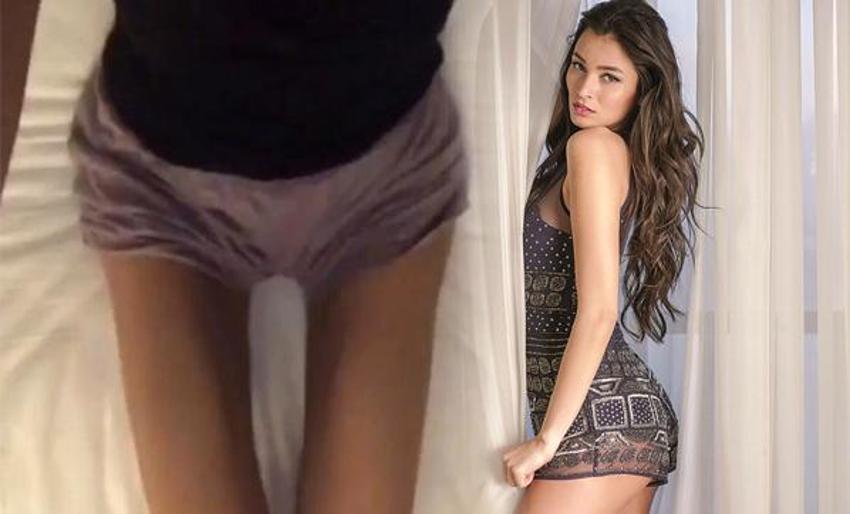 İrem Derici'nin hastalığı bu hale getirmişti!