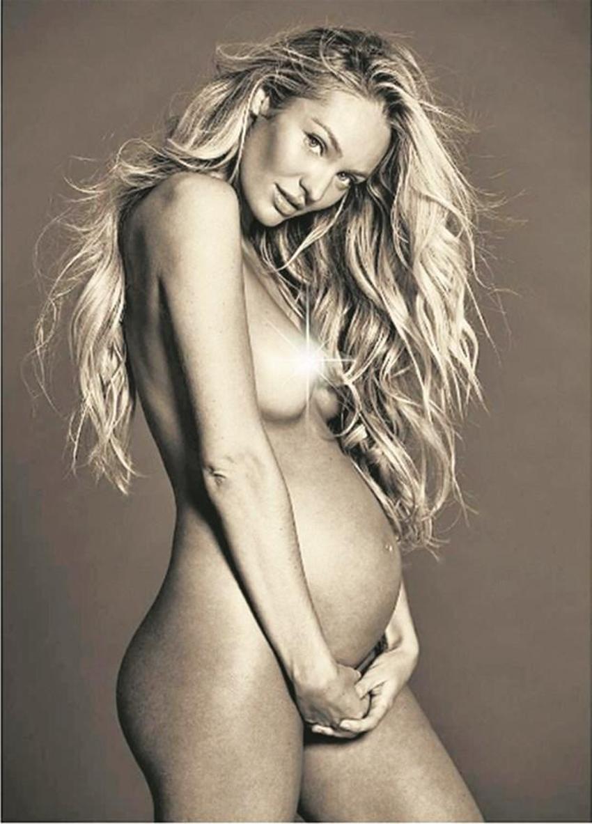 Candice Swanepoel'dan kötü haber!