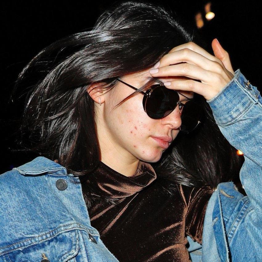 Kendall Jenner'dan 'sivilce' açıklaması!