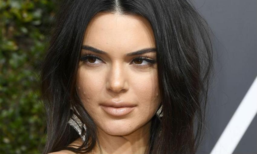 Kendall Jenner'dan 'sivilce' açıklaması!
