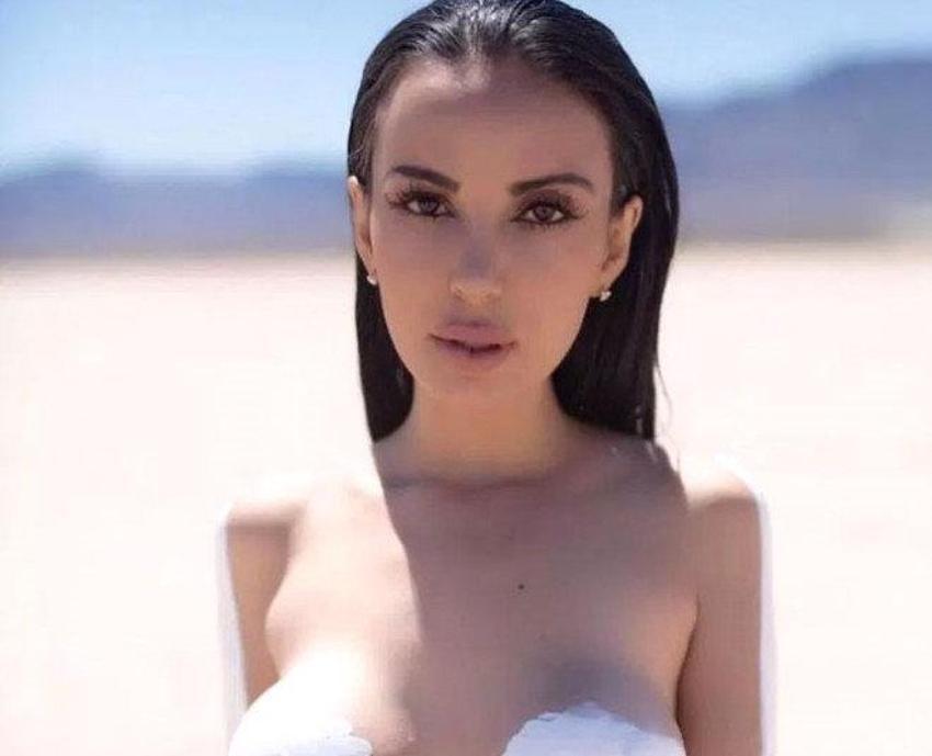 Kardashian'a benzemek için Türkiye'ye geldi!