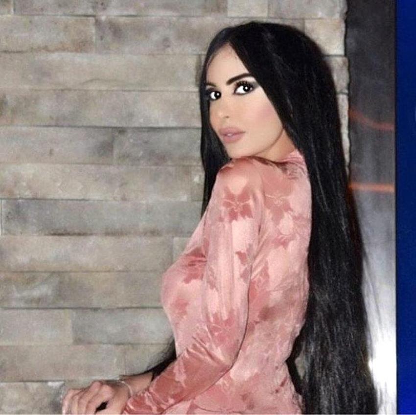 Kardashian'a benzemek için Türkiye'ye geldi!
