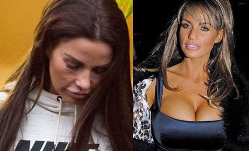 Katie Price'ten üzücü haber! Yüzü...