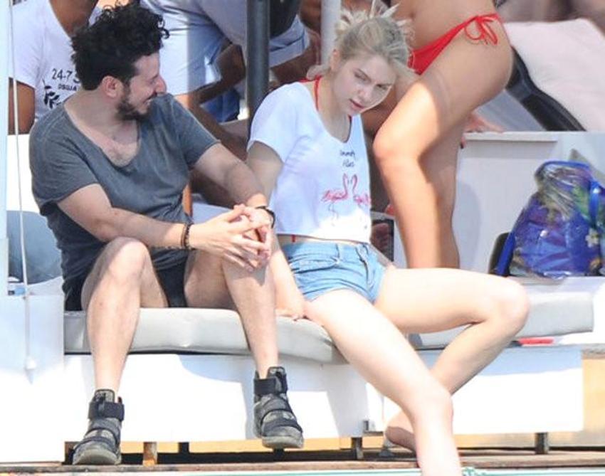 17 yaşındaki Aleyna Tilki'den dudaklarına operasyon!