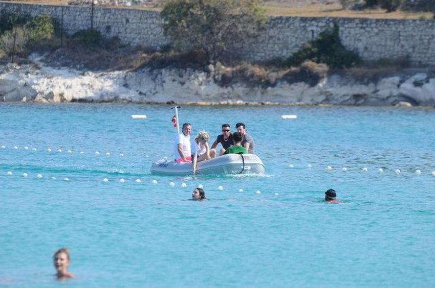 17 yaşındaki Aleyna Tilki'den dudaklarına operasyon!