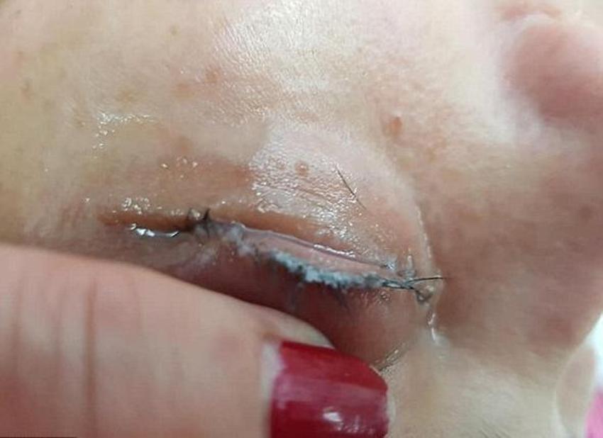 Güzellik uğruna dehşeti yaşadı!