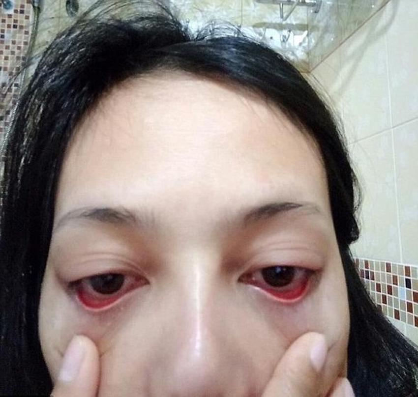Güzellik uğruna dehşeti yaşadı!