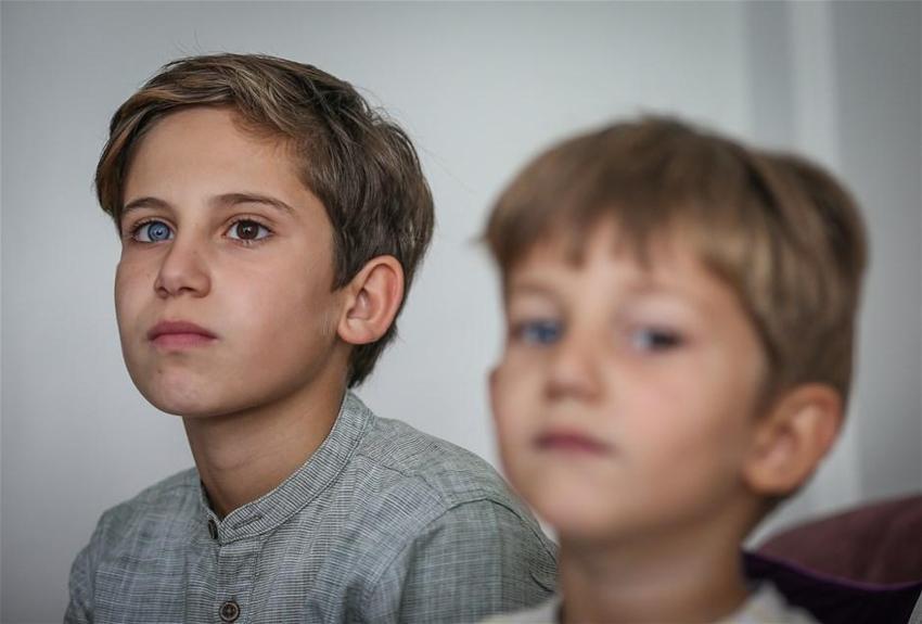 İki renkli göze sahip kardeşler görenleri şaşırtıyor!