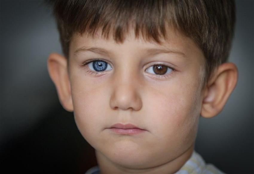 İki renkli göze sahip kardeşler görenleri şaşırtıyor!