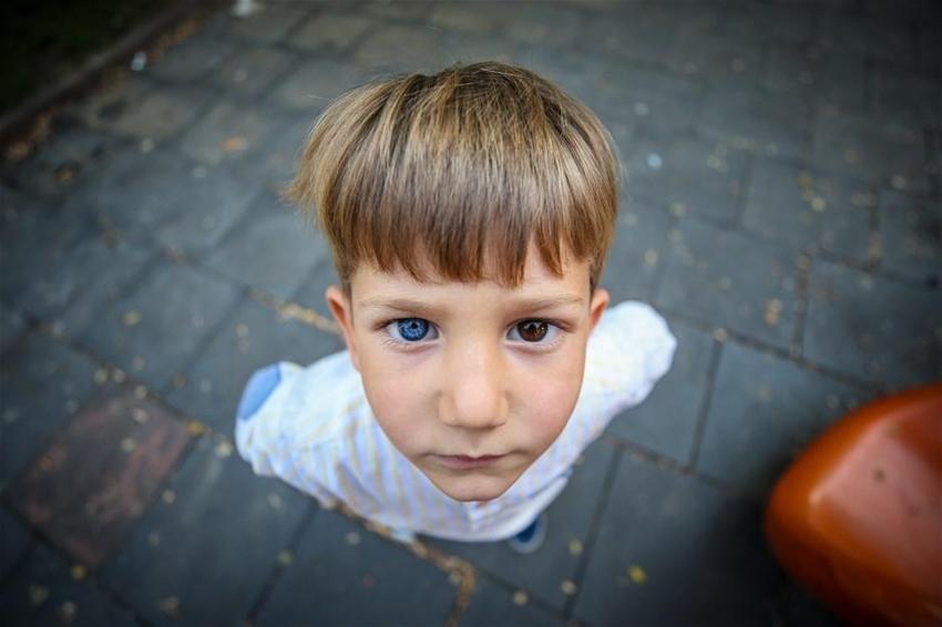 İki renkli göze sahip kardeşler görenleri şaşırtıyor!