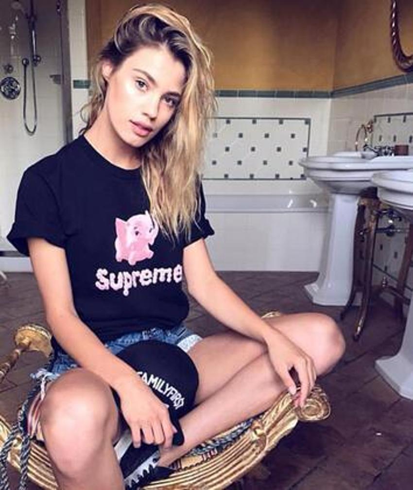 'Bacağını kesmeliyiz' denilen ünlü model mesleğine dönüyor