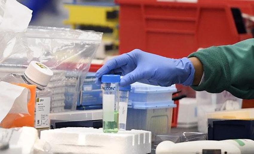 Nobel ödüllü doktor corona virüsün nasıl ortaya çıktığını açıkladı