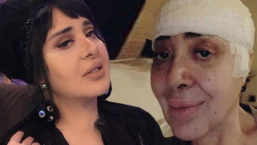 Nur Yerlitaş iki gün önce ayağını kırmış!