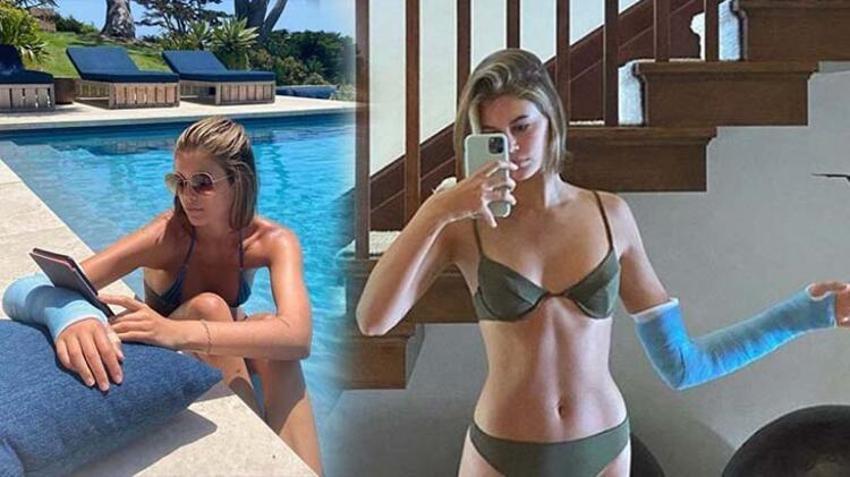Model Kaia Gerber kolunu kırdı