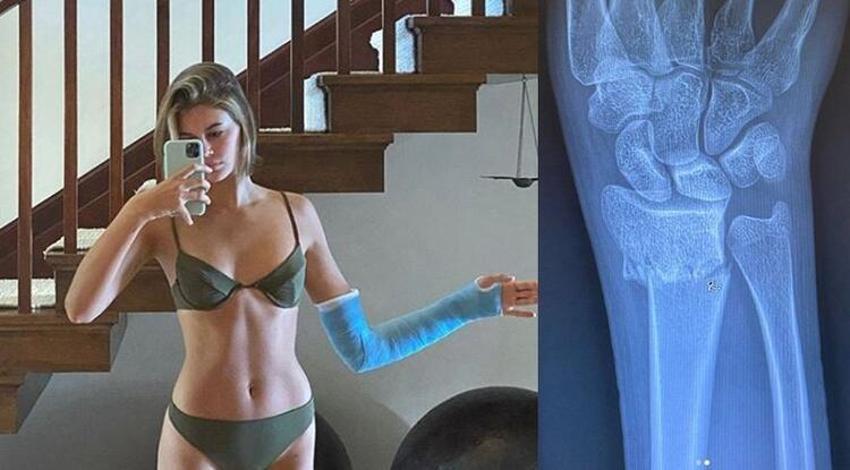 Model Kaia Gerber kolunu kırdı