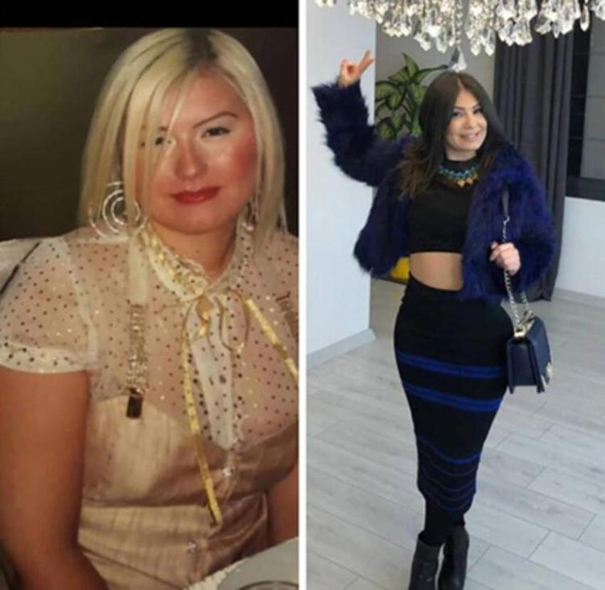 2 çocuk annesi kadın 22 estetik operasyon için 240 bin TL harcadı!