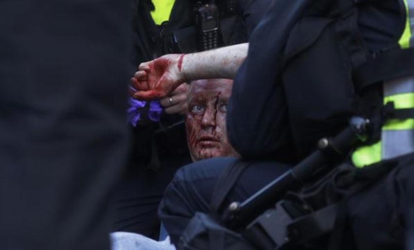Londra'da savaş alanına döndü! Çatışma çıktı...
