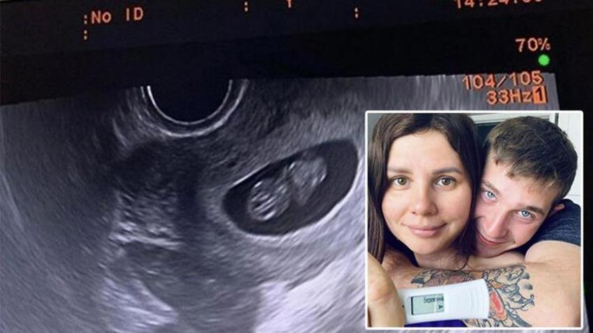 Ünlü fenomen üvey oğlundan hamile kaldı! Rezaletin her saniyesini paylaştı
